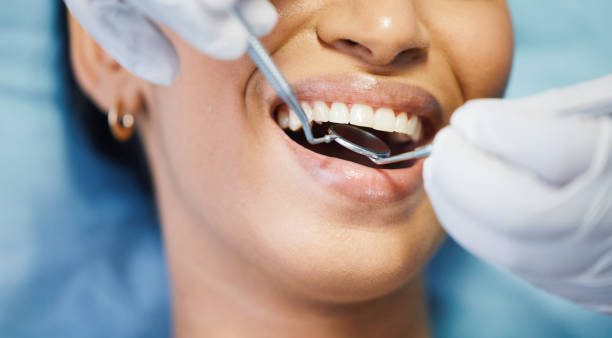 Best Emergency Wisdom Teeth Removal in Blandon, PA
